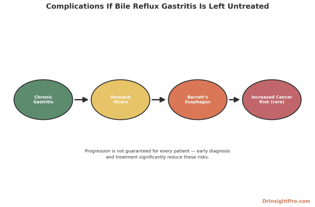 Diagram showing complications of untreated bile reflux gastritis progressing from chronic gastritis to stomach ulcers Barrett's esophagus, and cancer risk