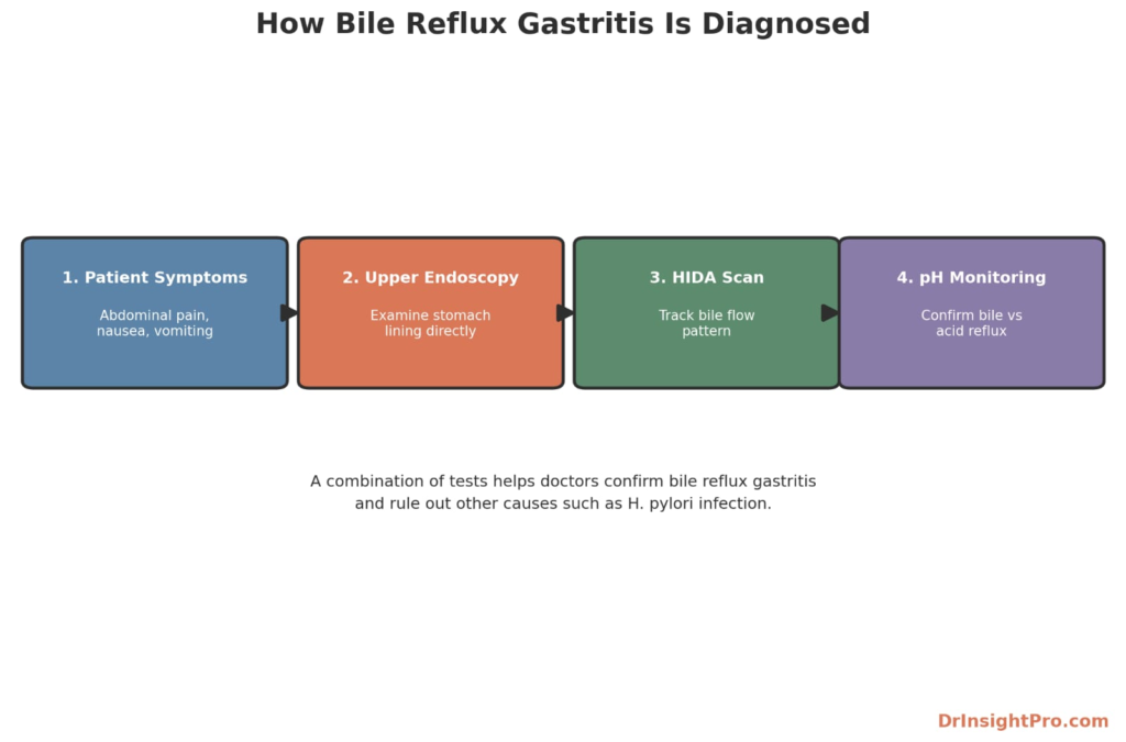 Flow diagram showing four steps to diagnose bile reflux gastritis: symptoms, endoscopy, HIDA scan, and pH monitoring